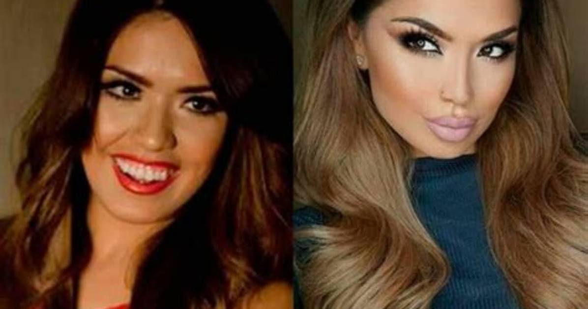 Iluvsarahii's Bbl Transformation: Before and After