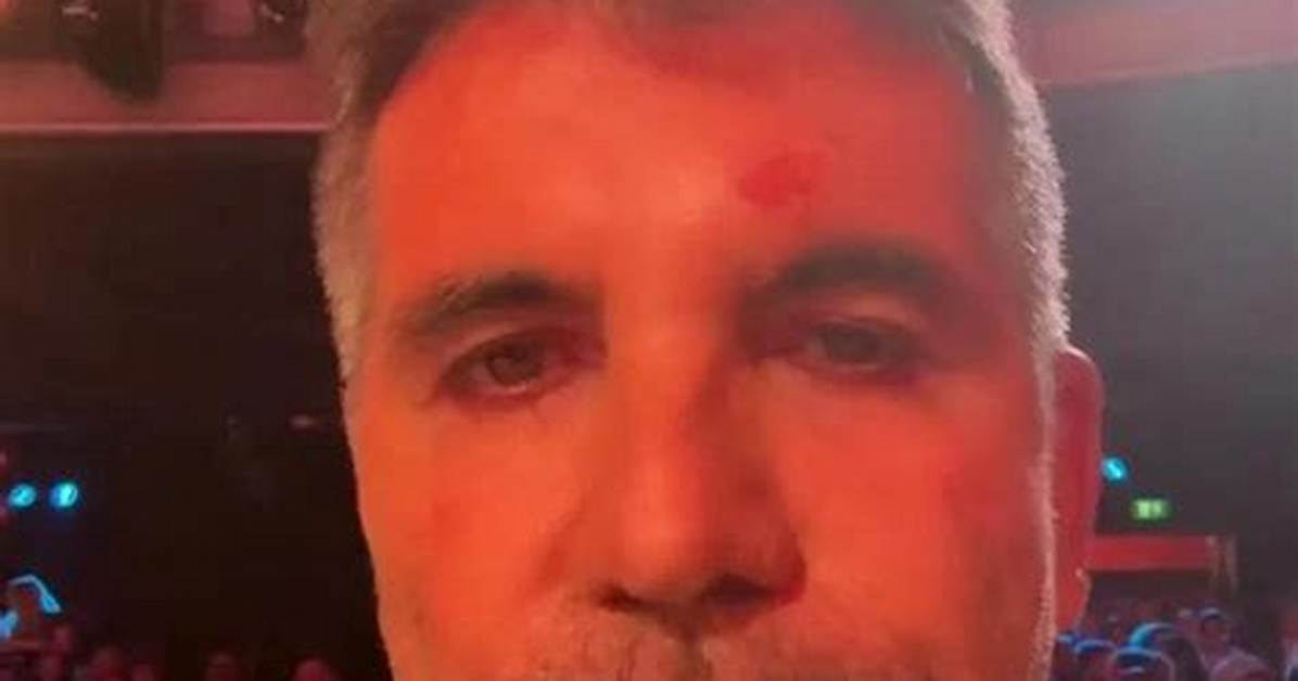 Is Simon Cowell Sick? Unraveling the Truth Behind the Music Icon's Health