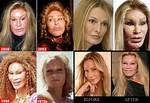 Jocelyn Wildenstein Before Plastic Surgery: Her Look