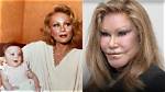 Jocelyn Wildenstein's Plastic Surgery Transformation: Before and After
