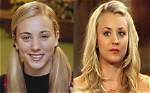 Kaley Cuoco's Journey with Breast Augmentation