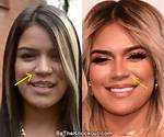 Karol G Before and After: Unveiling Her Transformation Journey