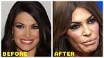 Kimberly Guilfoyle: Beauty, Politics, and the Plastic Surgery Rumors