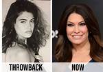 Kimberly Guilfoyle's Plastic Surgery Journey: Unveiling the Truths