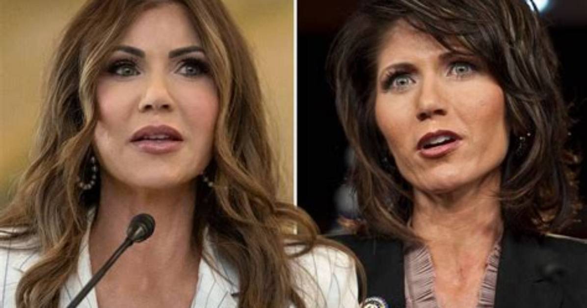 Kristi Noem's Appearance Before Surgery: a Transformation Revealed