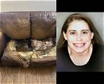 Lacey Fletcher: the Story Behind the Clear Photo