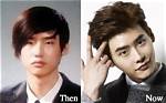 Lee Jong Suk | Before Plastic Surgery? Wrong with His Face?