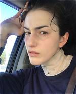 Lilli Kay: a Transformation Journey Through Before and After Pictures