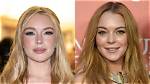 Lindsay Lohan's Plastic Surgery Journey Explored