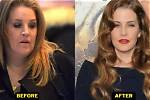 Lisa Marie Presley's Weight Gain Journey: Unveiling the Untold Truth
