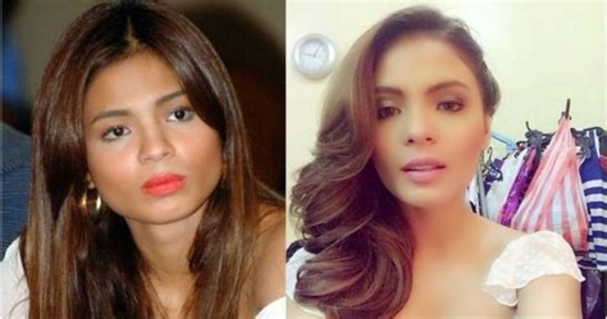 Lovi Poe Before Surgery | Filipino Actress Plastic Transformation