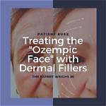 Lupus and Taking Ozempic: Understanding the Connection