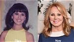 Marlo Thomas's Plastic Surgery Journey