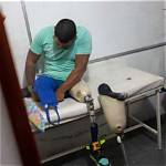 Mason Leg Amputated Surgery: Understanding the Procedure and Recovery