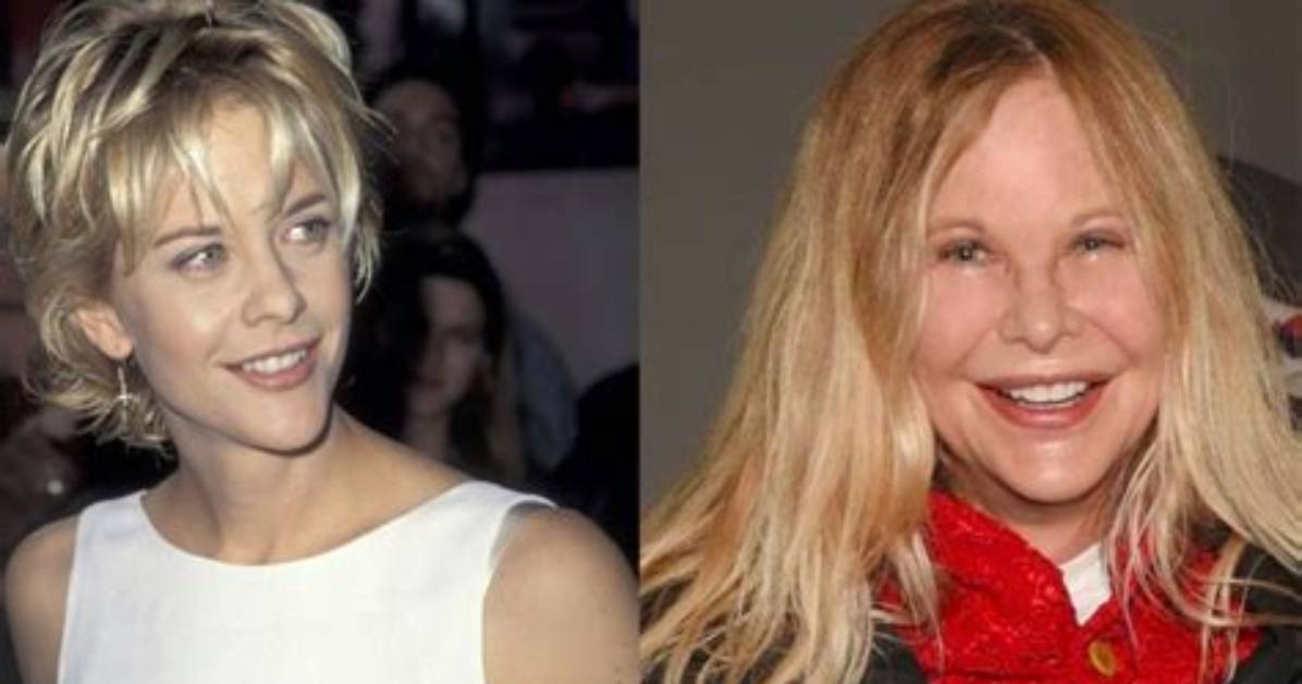 Meg Ryan Addresses Plastic Surgery Rumors in Glamour Interview