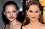 Natalie Portman Nose Job Plastic Surgery Before And