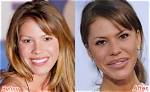 Nikki Cox Plastic Surgery Before and After