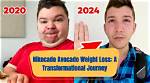 Nikocado Avocado's Weight Loss Journey: Tips and Motivation