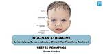 Noonan Syndrome and Its Notable Figures: Uncovering the Famous
