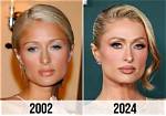 Paris Hilton's Nose: the Ultimate Guide to Her Changing Appearance