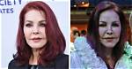 Plastic Surgery, Fame, and Beyond