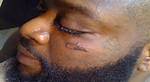 Rick Ross Gets Cazal Logo Face Tattoo |