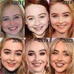 Sabrina Carpenter: Embracing Natural Beauty Without Surgery