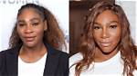 Serena Williams' Plastic Surgery Journey: a Comprehensive Overview