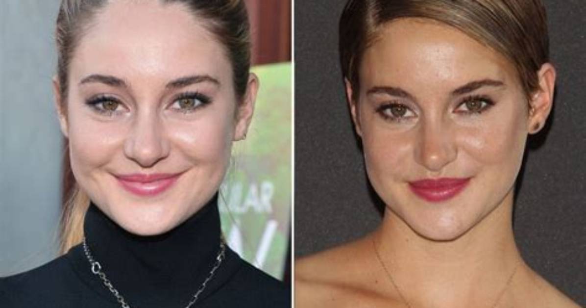 Shailene Woodley's Nose Job Journey: Before and After Transformation