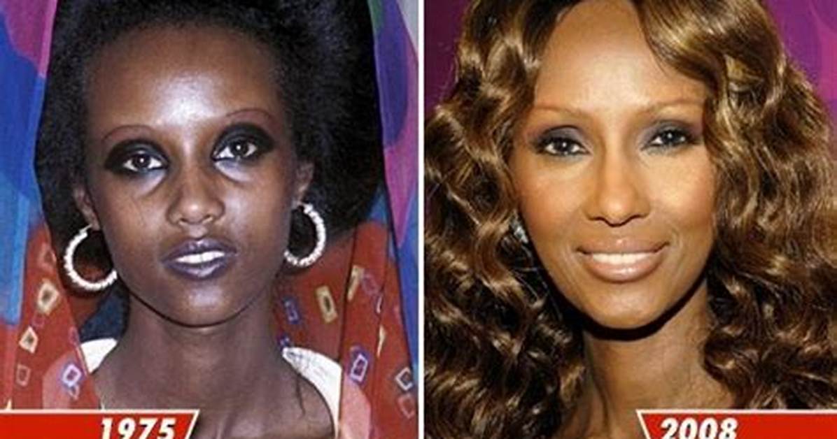 Skin Bleaching Practices Among Celebrities Revealed
