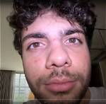 Spoonkid Face Reveal: Unmasked and Unfiltered