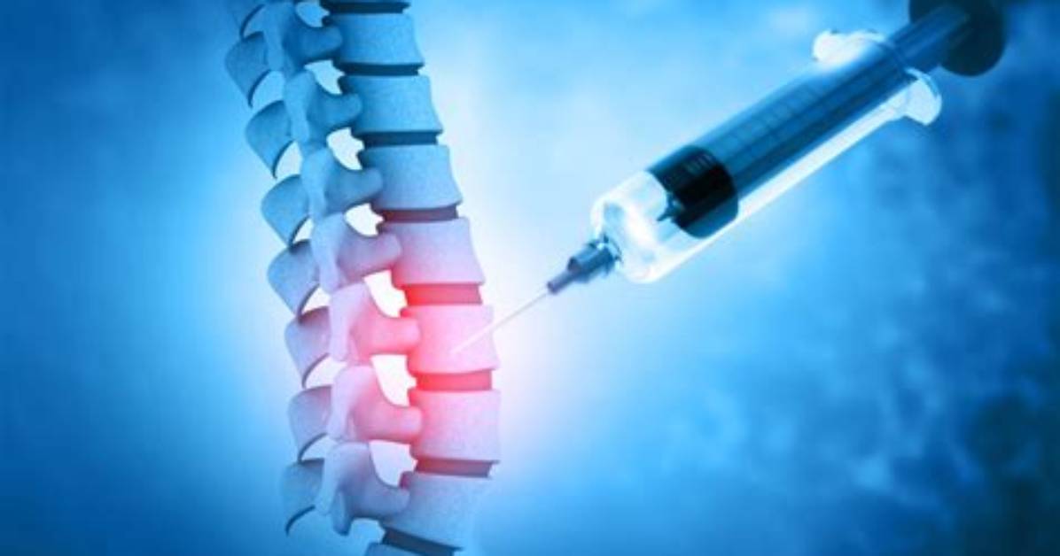 Taylor Syring: Revolutionary Spinal Fluid Management