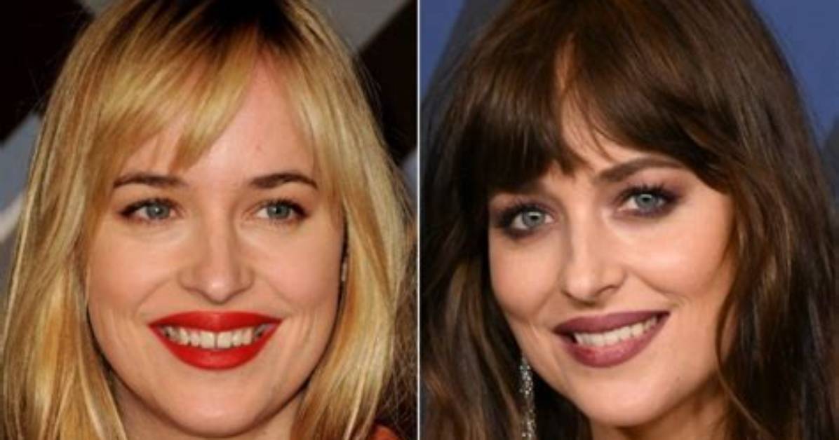 The Best Celeb Tooth Transformations