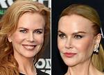 The Evolution of Nicole Kidman's Plastic Surgery: Before and After
