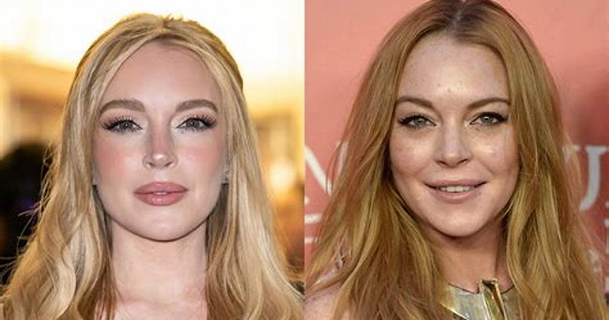 The Plastic Surgery Journey of Lindsay Lohan