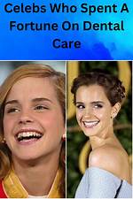The Surprising Truth About Celebrities' Secret Dental Struggles