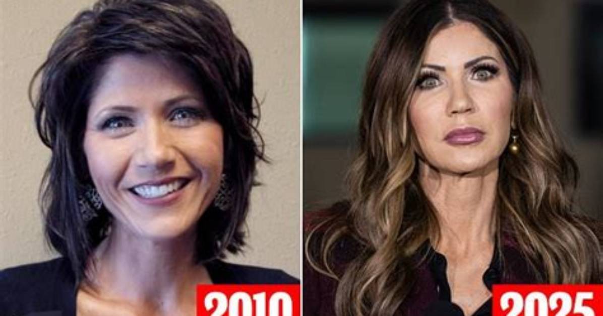 The Transformation of Kristi Noem: Before and After Plastic Surgery Reveal