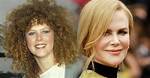 The Transformation of Nicole Kidman: a Visual Timeline of Plastic Surgery