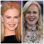 The Truth About Nicole Kidman's Surgeries: the Complete Guide