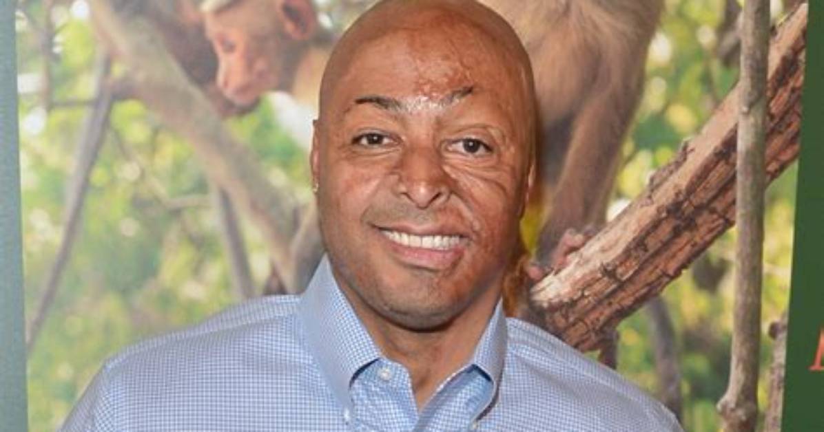 These Actors Might Be Famous Because of Their Facial Scars