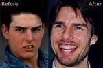 Tom Cruise's Perfect Smile: Secrets of His Pristine Teeth Revealed
