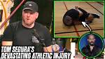 Tom Segura's Injury: the Story Behind the Comedian's Unexpected Setback