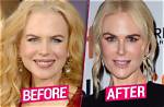 Transformations of Nicole Kidman: a Journey Through Time