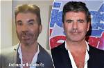 Uncover the Ailment Affecting Simon Cowell's Son: a Comprehensive Guide