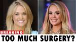 Uncovering Her Journey Before Plastic Surgery