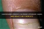 Understanding Horizontal Ridges on Fingernails: What Do They Indicate?