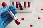 Understanding Usher Std: What You Need to Know