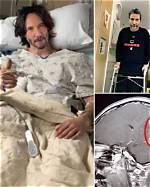 Unraveling the Mystery: Keanu Reeves' Medical Condition