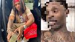 Unraveling the Mystery: King Von Cause of Death Autopsy