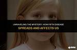 Unraveling the Mystery: What Disease Does Ron Perlman Have?